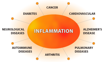 anxiety,depression,Miami holistic health coach,Miami psychologist, multiple sclerosis,obesity